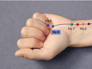 Hand zur Faust mit der Lage des Akupunktur-Punktes Herz 8