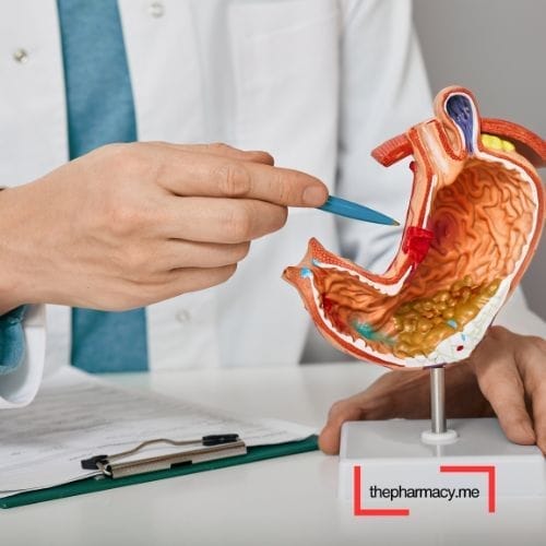 التهاب جدار المعدة بسبب الجرثومة