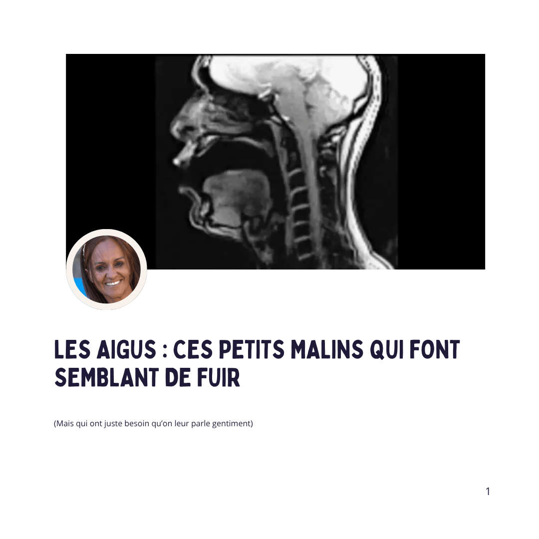Les aigus: ces petits malins 