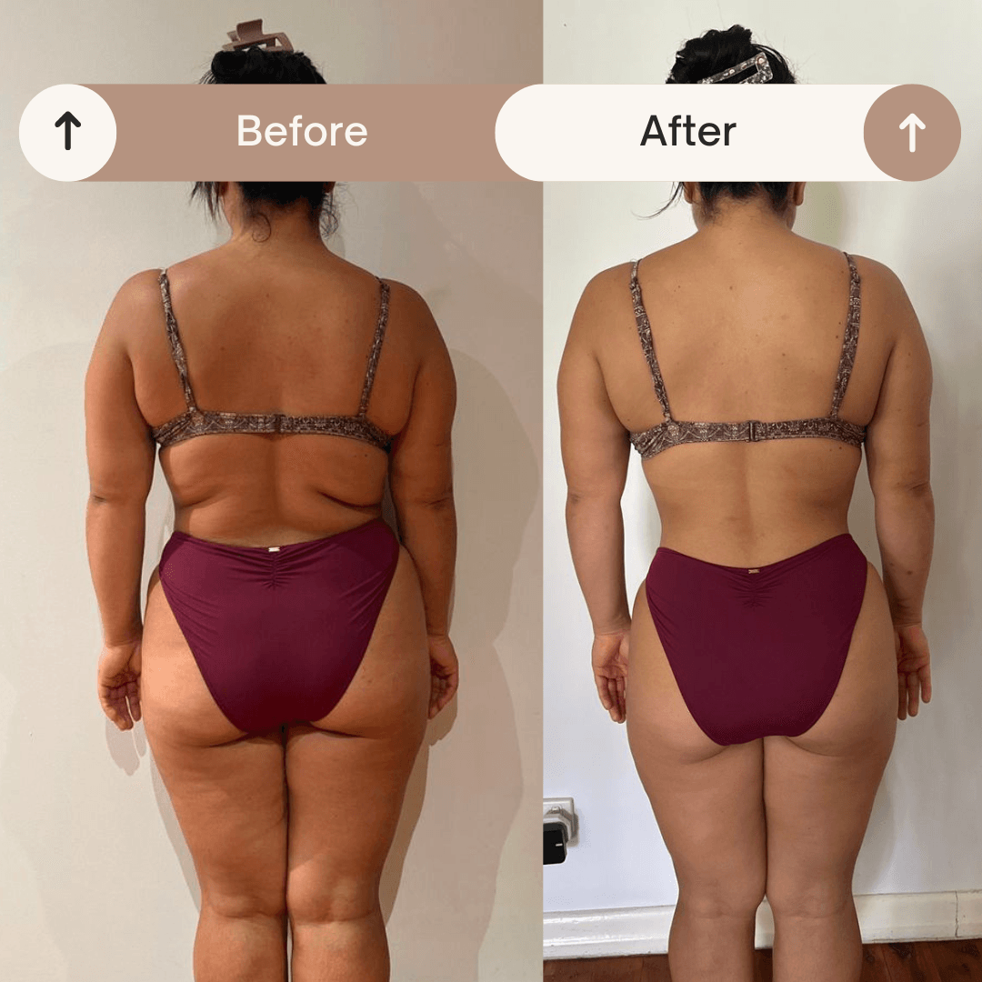 Resultado antes y después 1