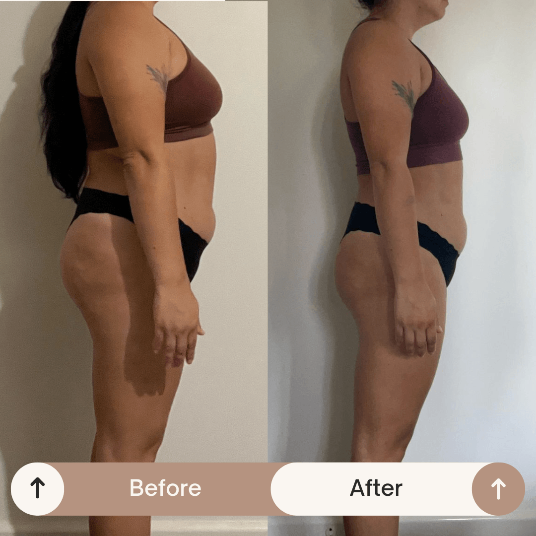 Resultado antes y después 4