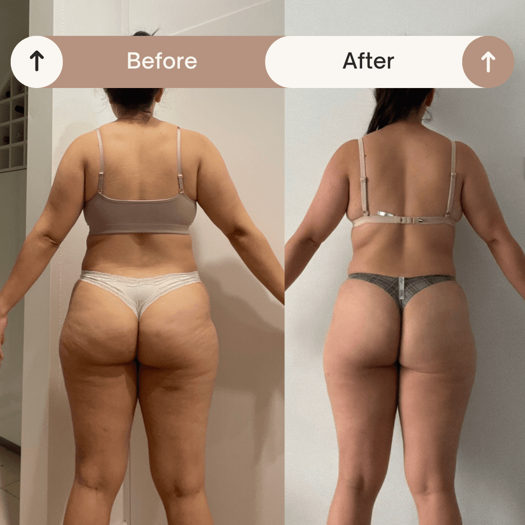 Resultado antes y después 5