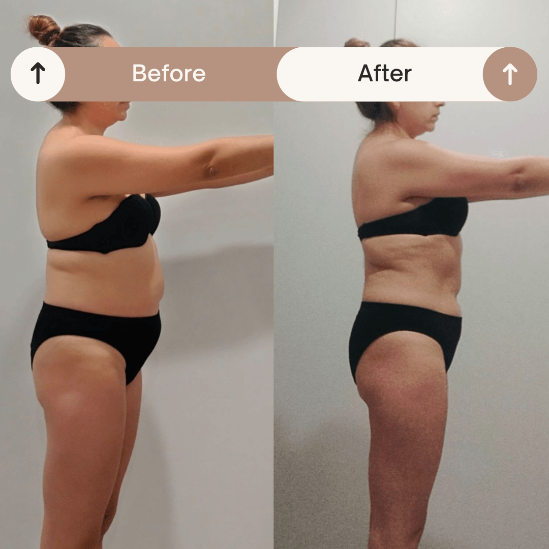Resultado antes y después 8
