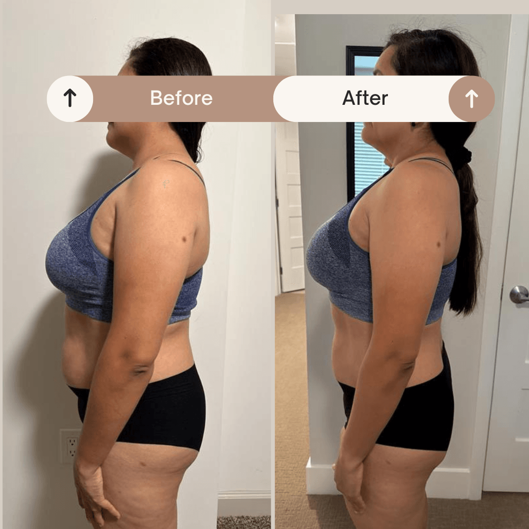Resultado antes y después 11