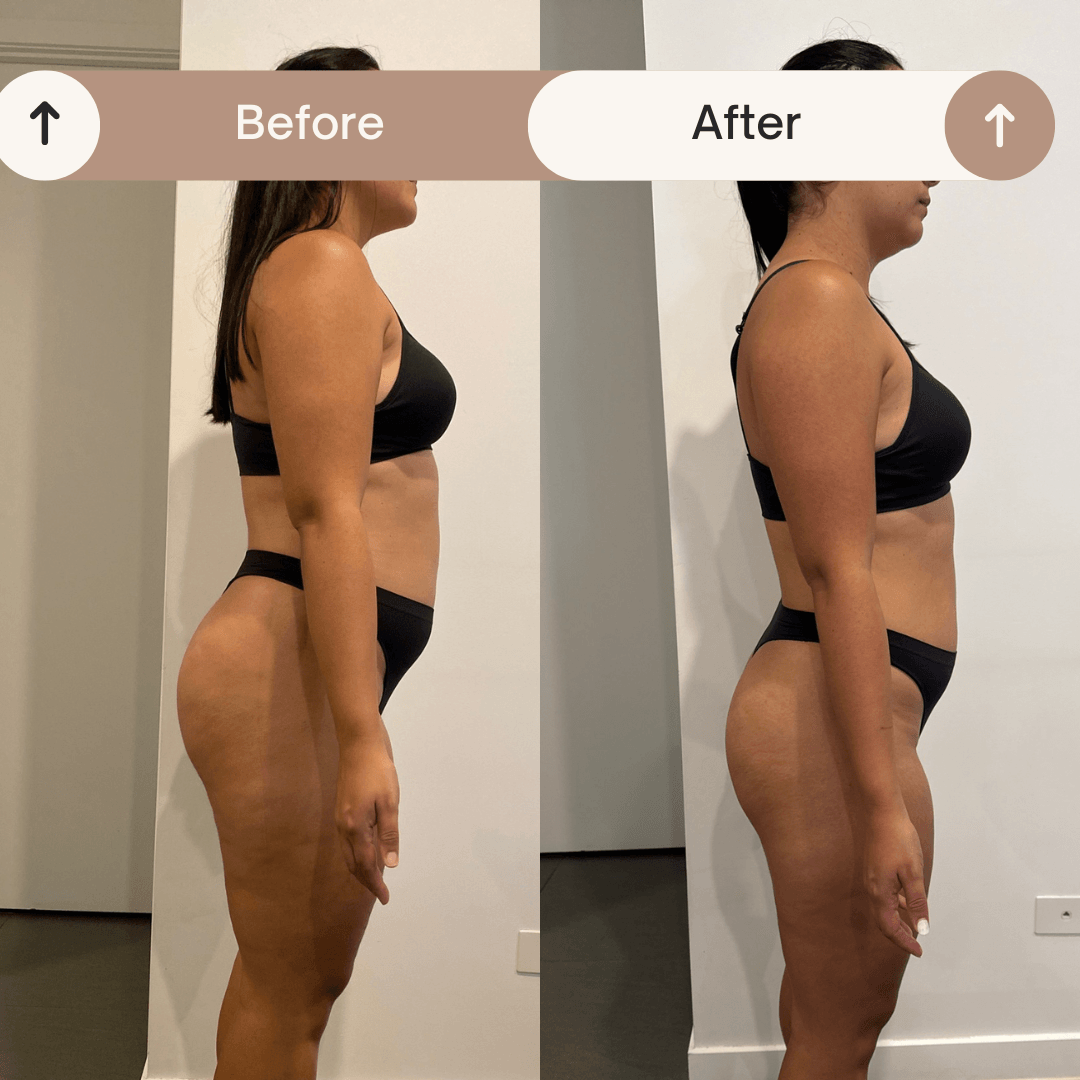Resultado antes y después 15