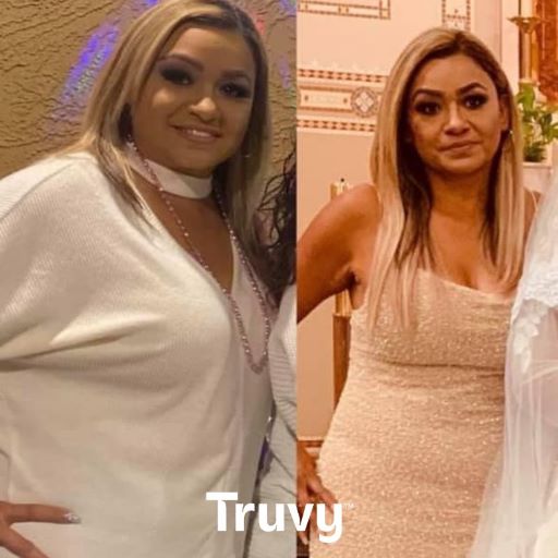 woman before and after weight loss with Truvy
