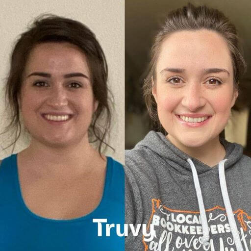woman's face before and after weight loss with Truvy 