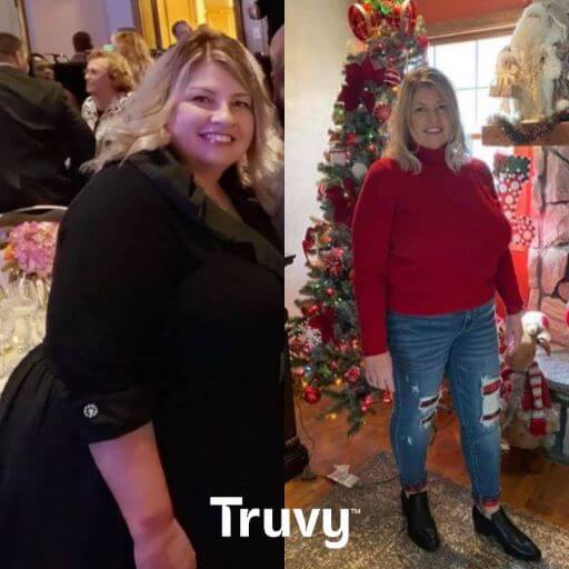 woman before and after weight loss with Truvy