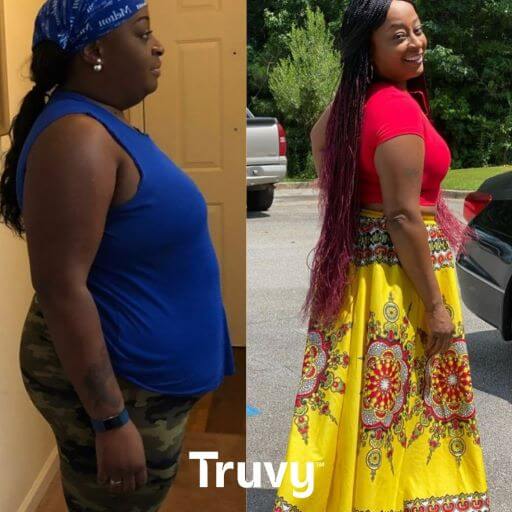 before and after Truvy weight loss testimonies 