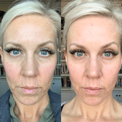 Truvy collagen results before and after 6 weeks