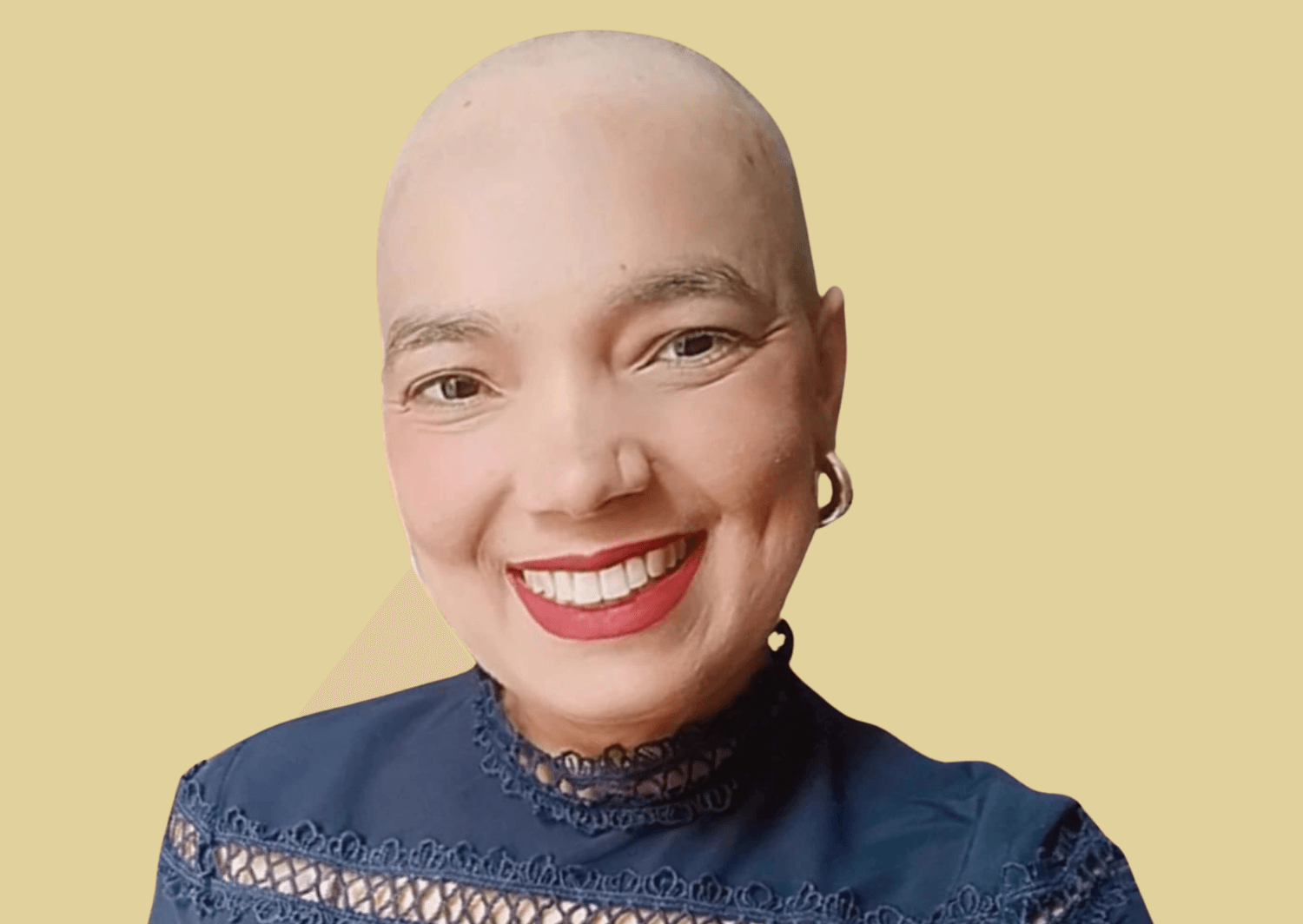 Mujer sonriente con la cabeza rapada, vestida con blusa azul, sobreviviente de cáncer de mama, transmitiendo fuerza, esperanza y bienestar emocional.
