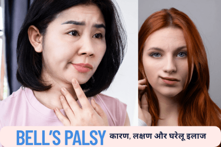 बेल्स पाल्सी (Bells Palsy): कारण, लक्षण और घरेलू इलाज 
