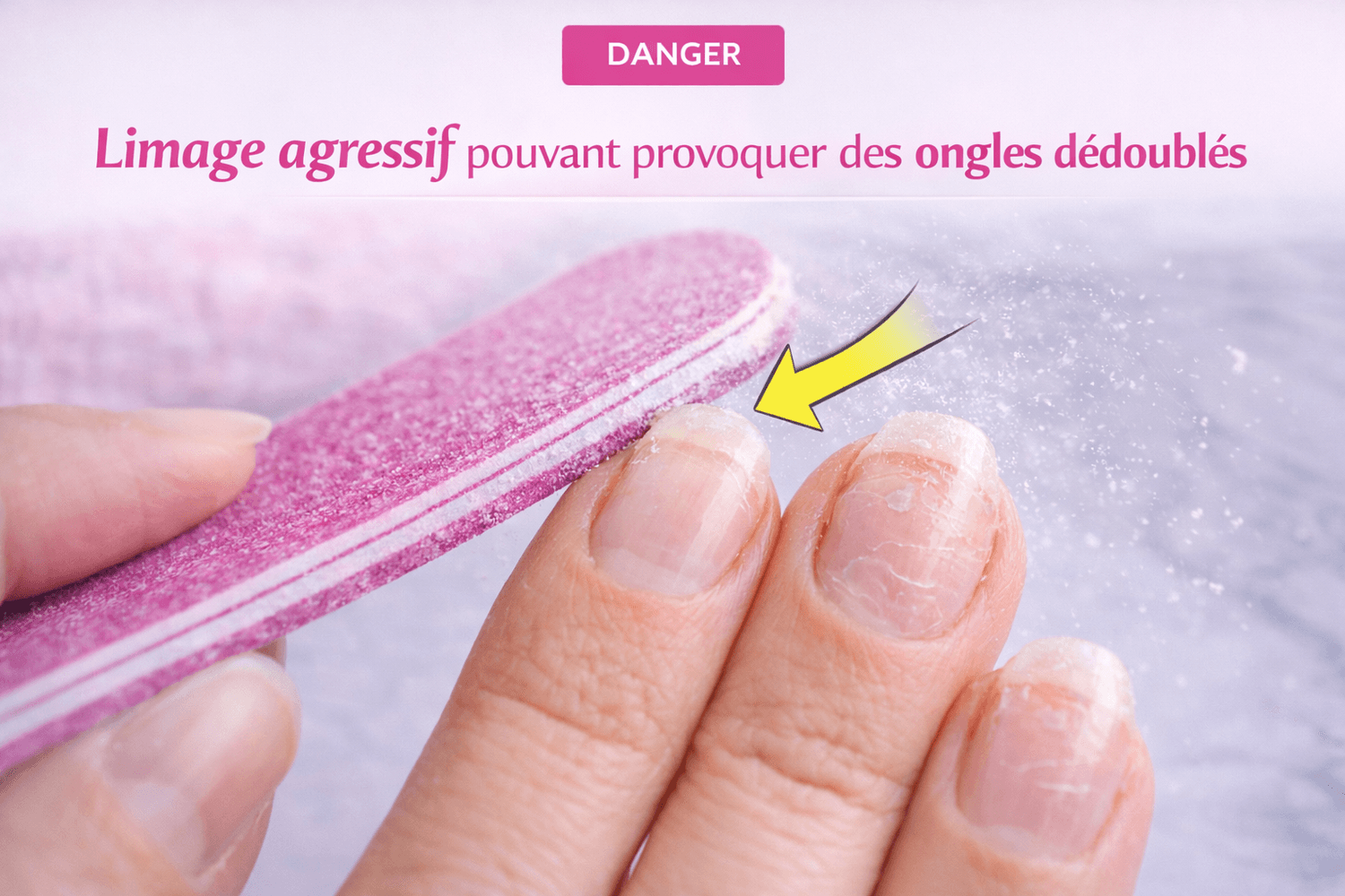 Limage agressif pouvant provoquer des ongles dédoublés