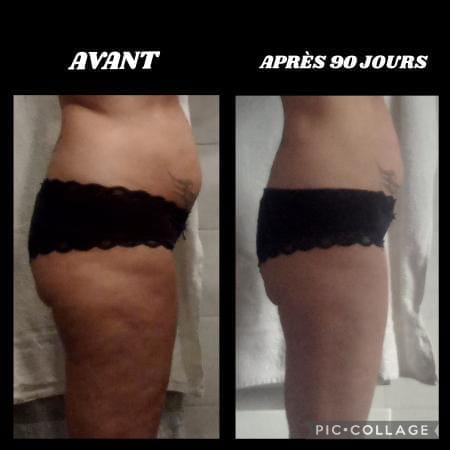 Avant / après MERAKI