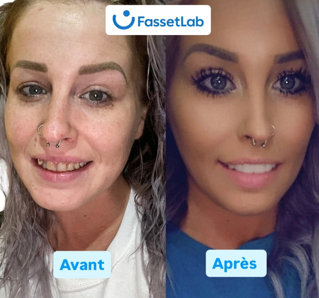 Transformation 3