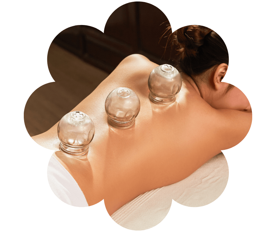 Hátmasszázs köpölyözéssel Győrben