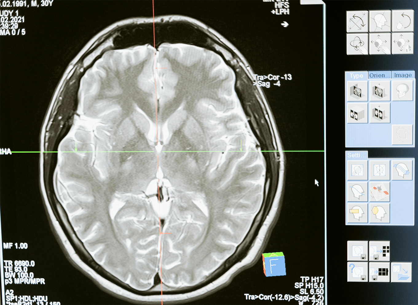 Reprogrammation mentale