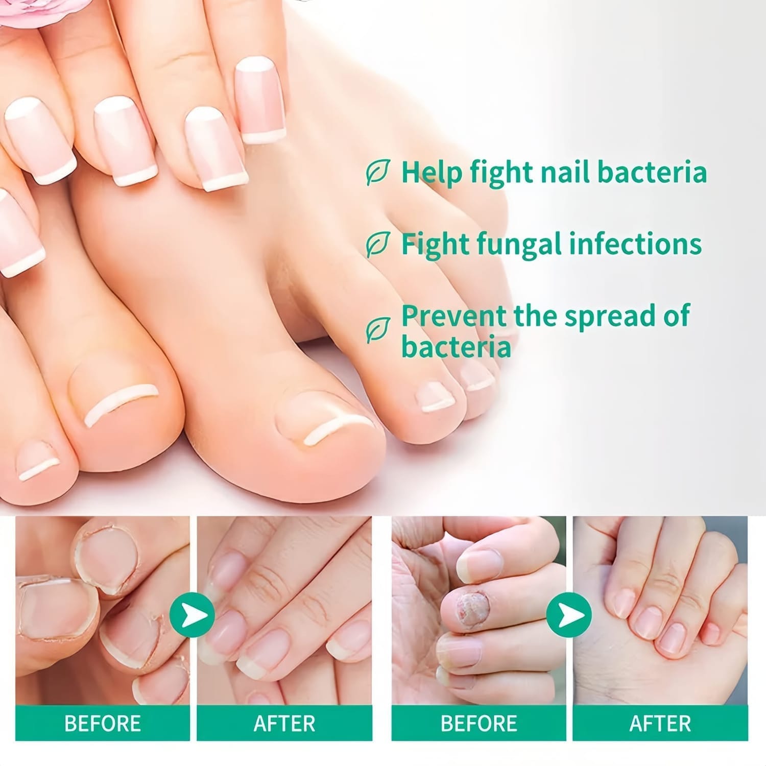Nail and cuticle results example