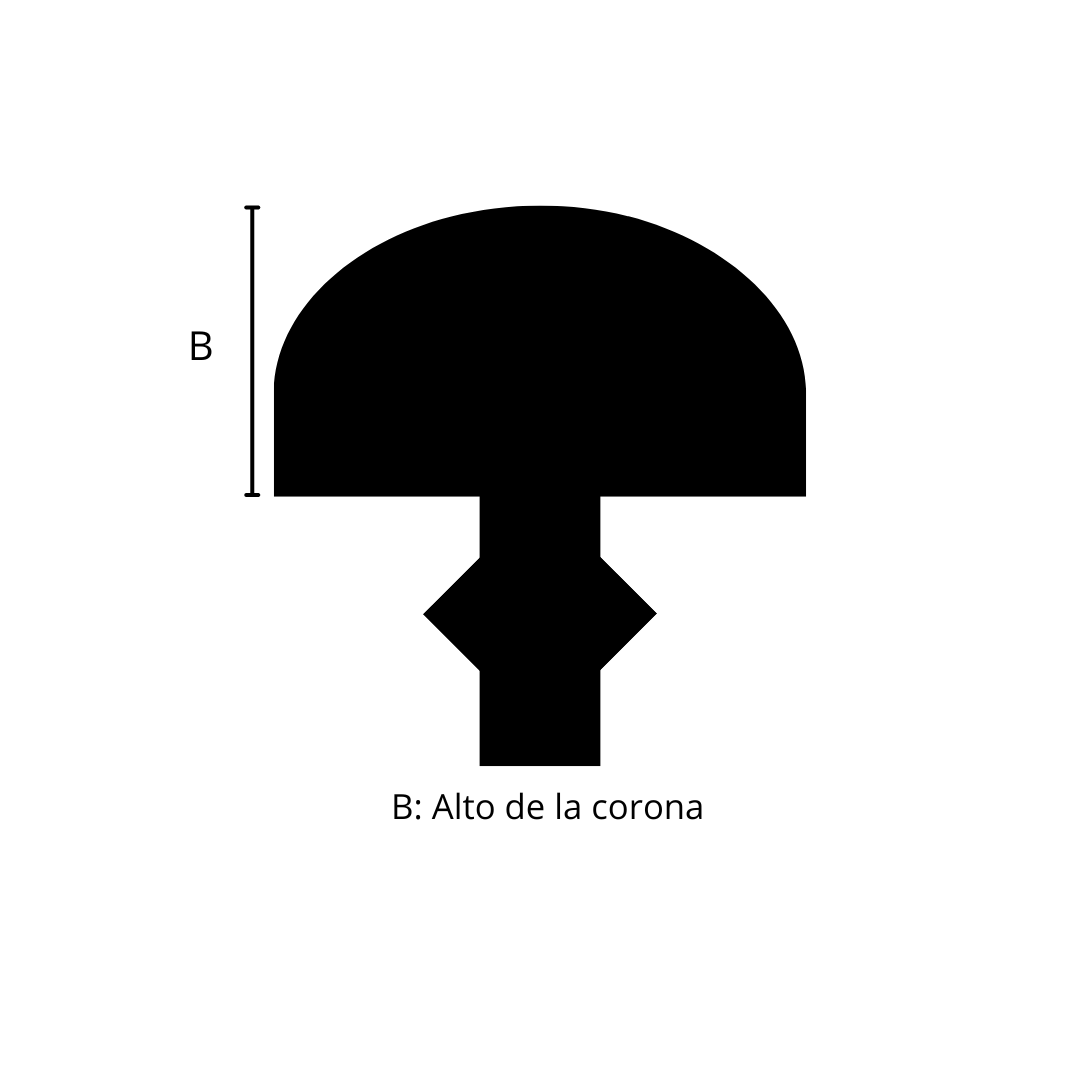 Fisonomía de un traste - Fret