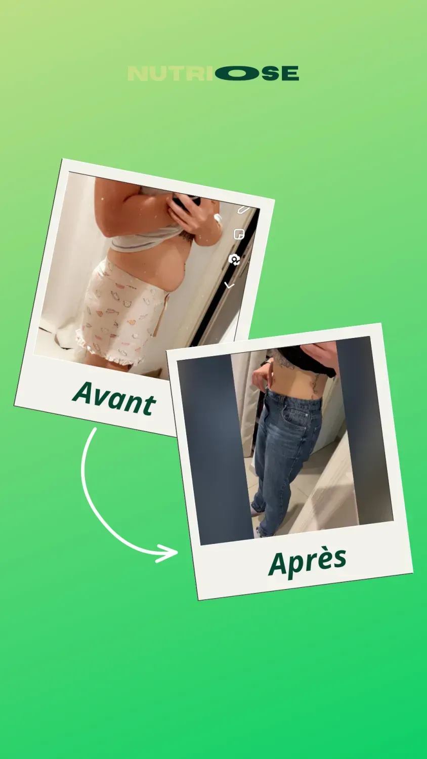 Photo avant-après Nutriose