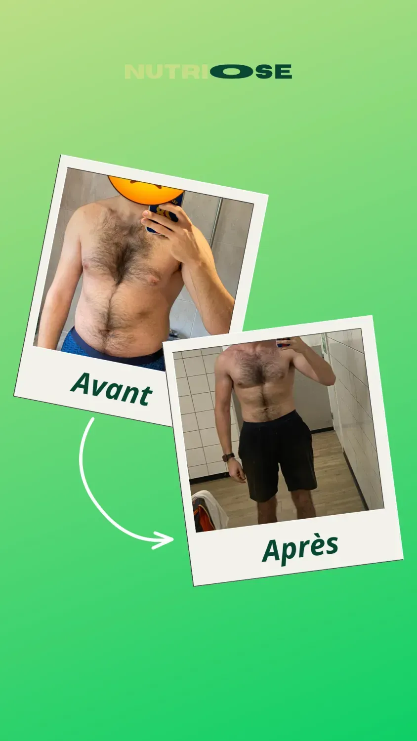 Photo avant-après Nutriose