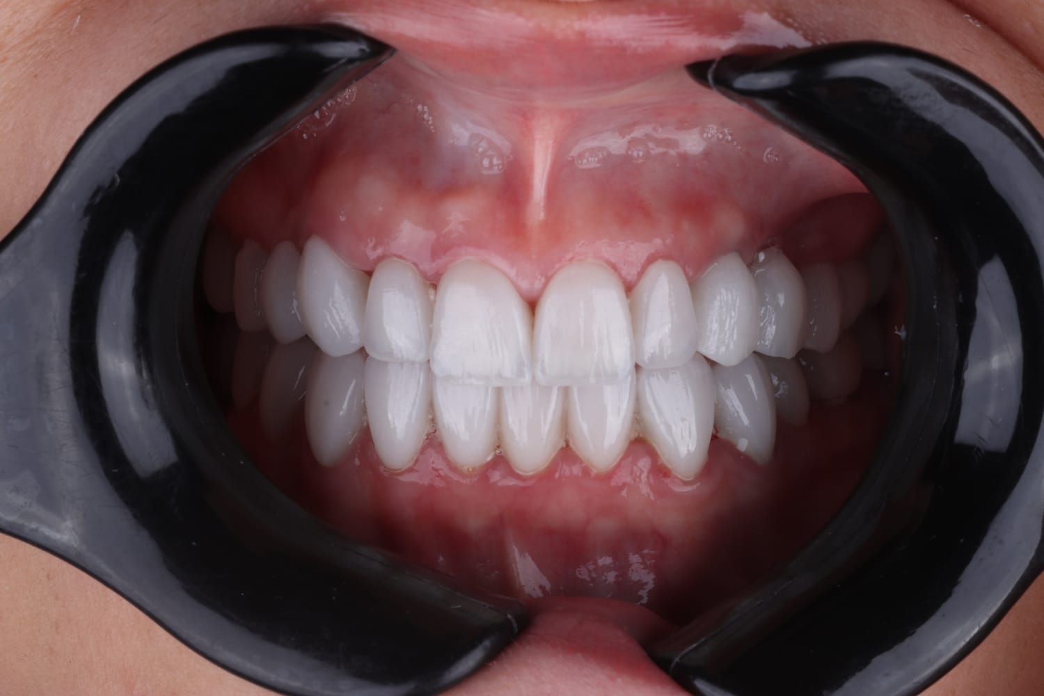 Before dental case