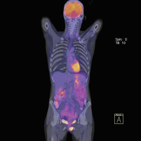 Equipo de PET/CT en instalación de medicina nuclear