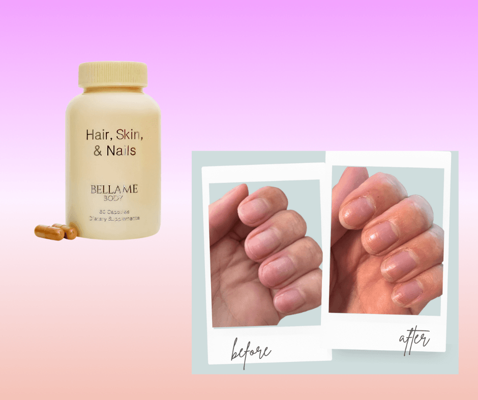 hair skin and nails supplement and before and after photo of nails