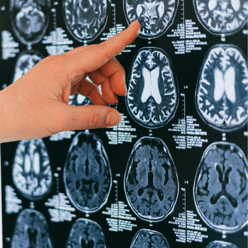 Illustration de cerveaux stylisés symbolisant la compréhension de la psychologie masculine pour mieux décrypter les comportements des hommes et favoriser la recherche d’un amour sincère et aligné