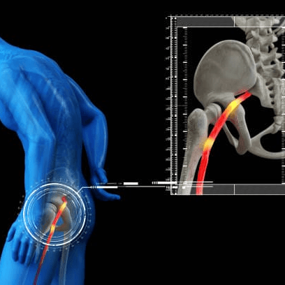 Sciatica Relief in Minutes A Simple Self-Help Guide Inside Book