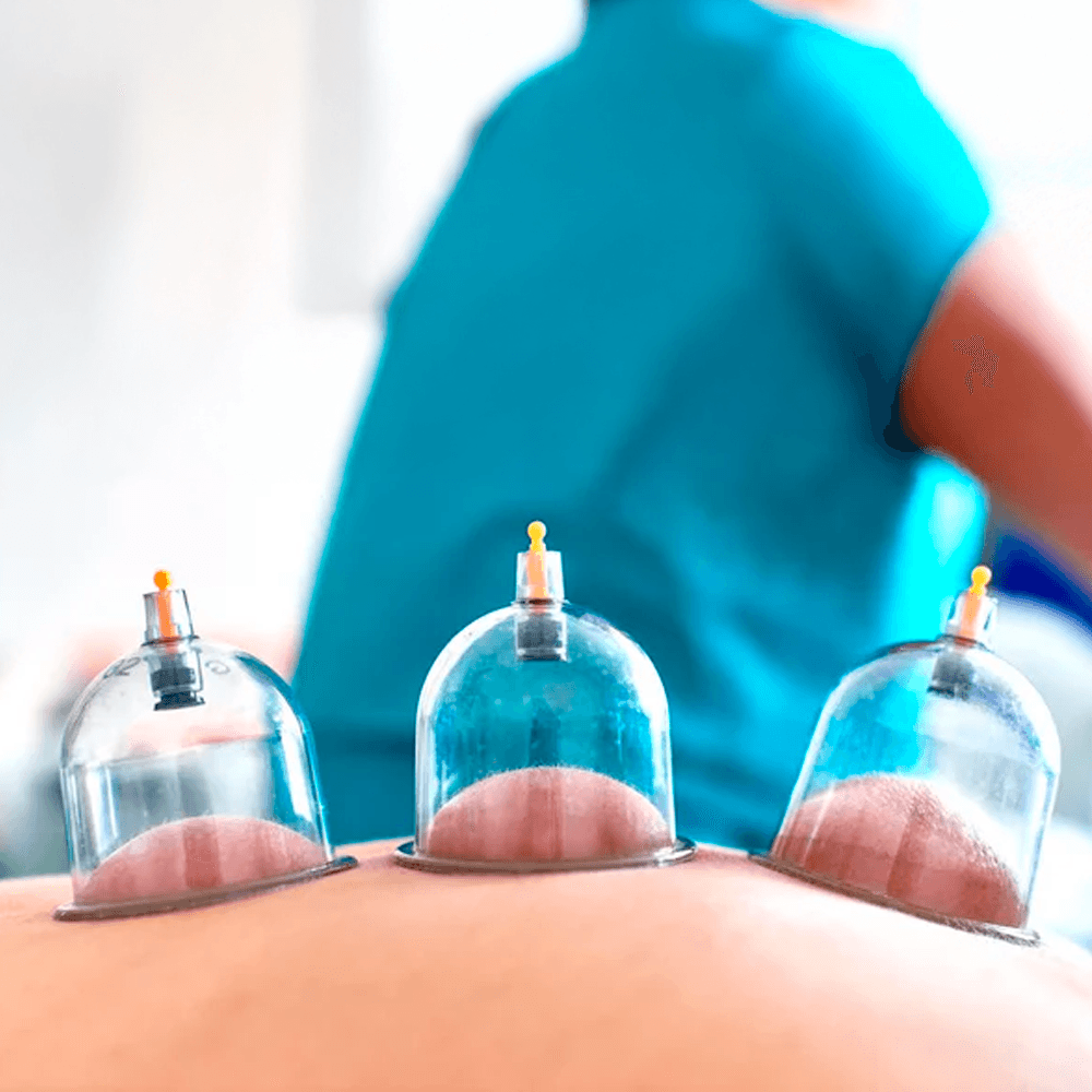 Hijama (ventouses) à Médine — praticien hygiéniste, aux dates 17, 19 et 21 du mois hégirien