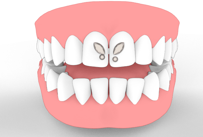 strass papillon asymetrique++