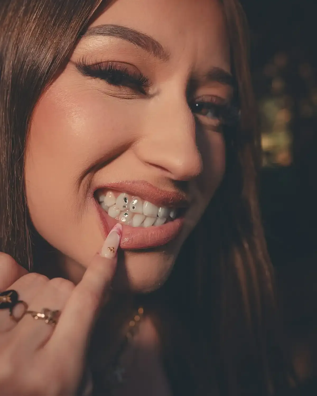 Bijou dentaire strass Swarovski - Avant/Après