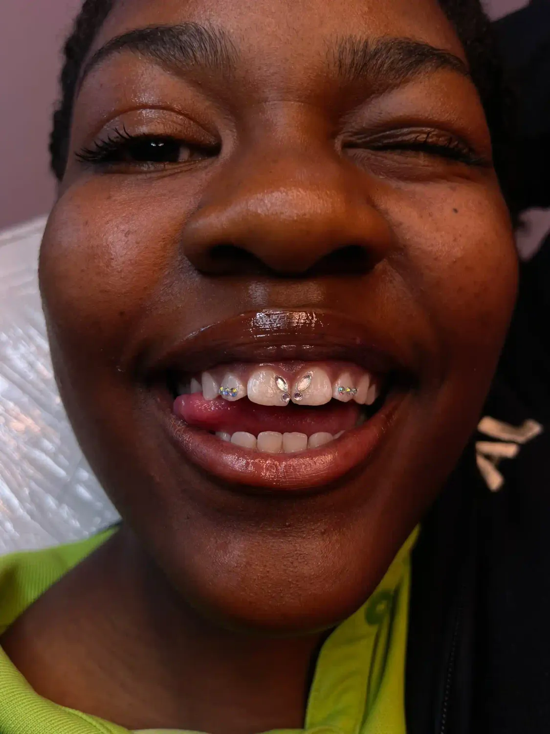 Cliente satisfaite suite à la pose d'un strass dentaire Swarovski