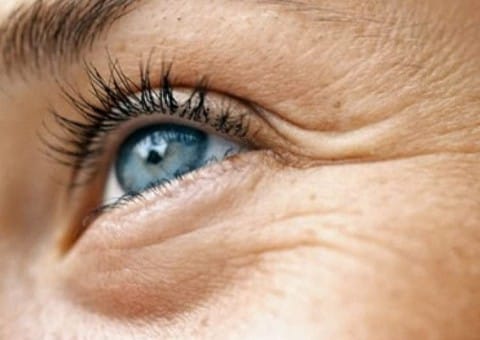 Close da região dos olhos de uma mulher com rugas e linhas de expressão.