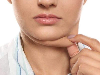 Perfil de uma mulher mostrando a região do pescoço com papada.