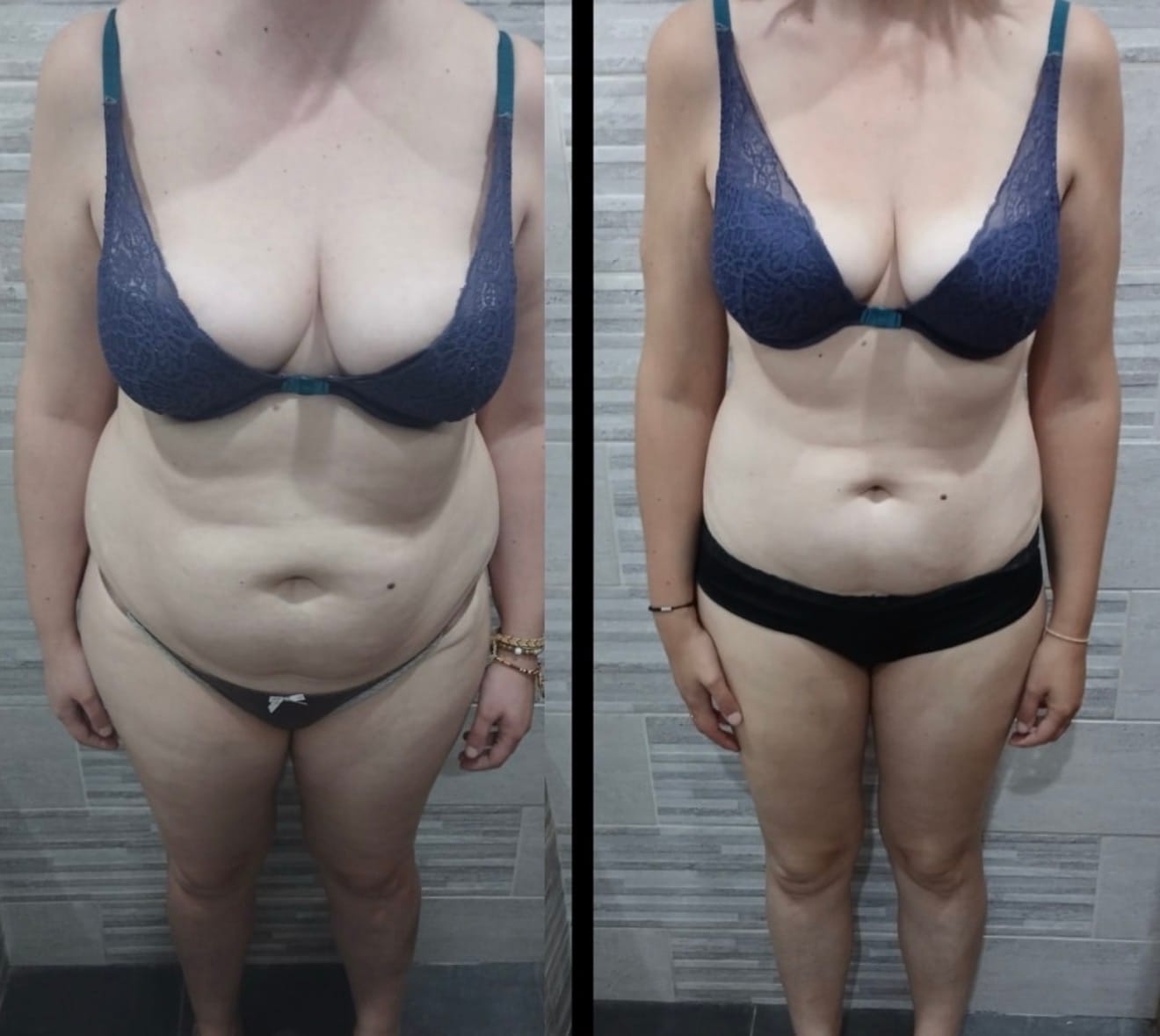 Mélanie -10 kg en 4 mois