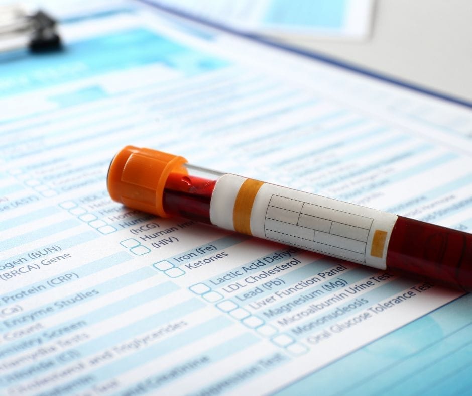 Röhrchen und Anforderungsbogen für die Bestimmung von Hormonen in den Wechseljahren. Mit Blut oder mit einem Speicheltest kann bestimmt werden, ob innere Unruhe, Nervosität, Schlafmangel oder Ängste durch die Wechseljahre oder Menopause verursacht werden