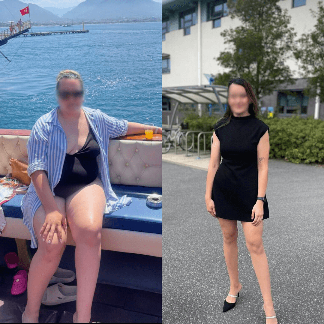 Before After - 48 kg slăbite