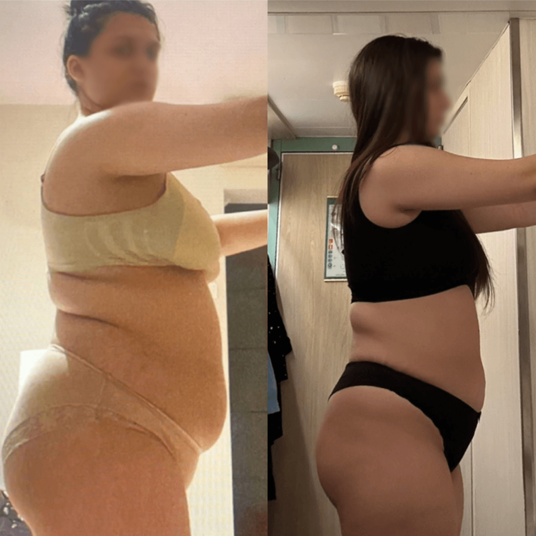 Before After - 17 kg slăbite