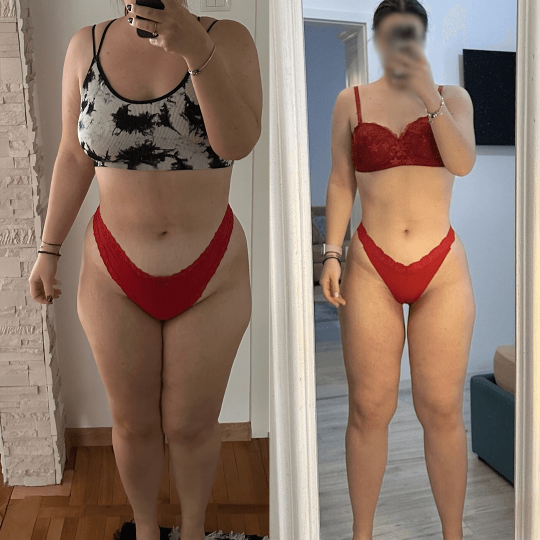 Before After - 14 kg slăbite