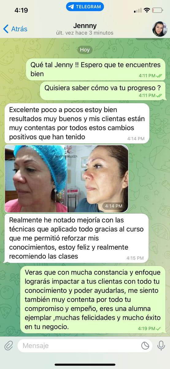 Resultado 4