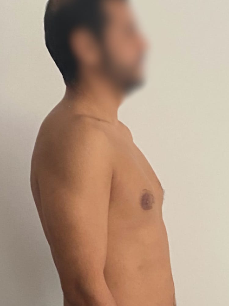 Amine après