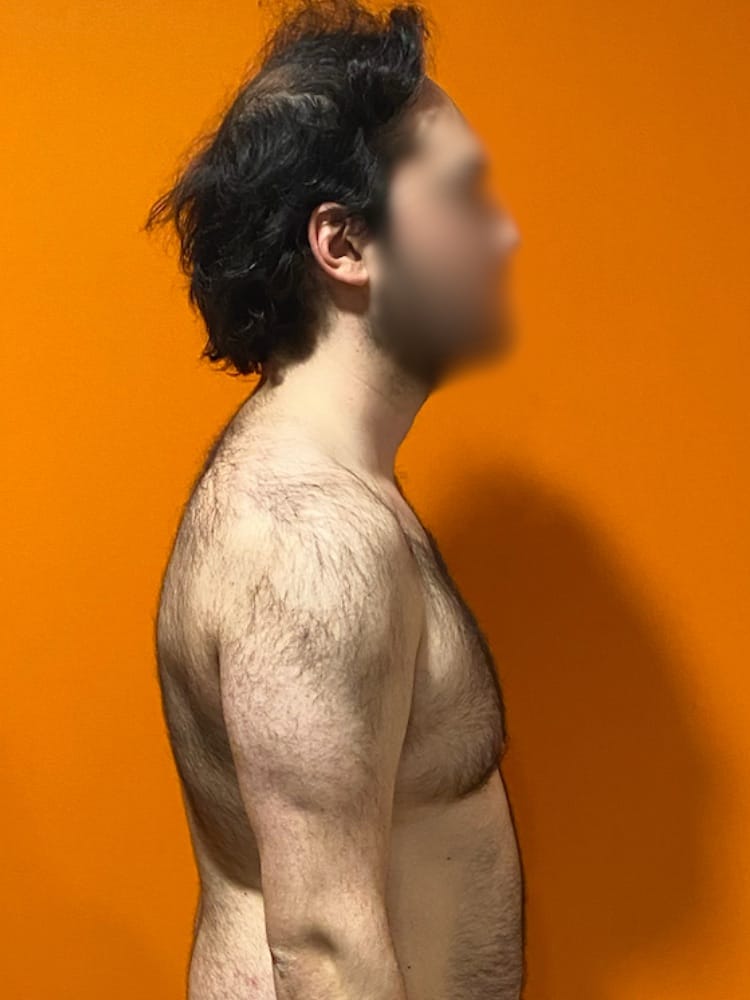 Aymeric après