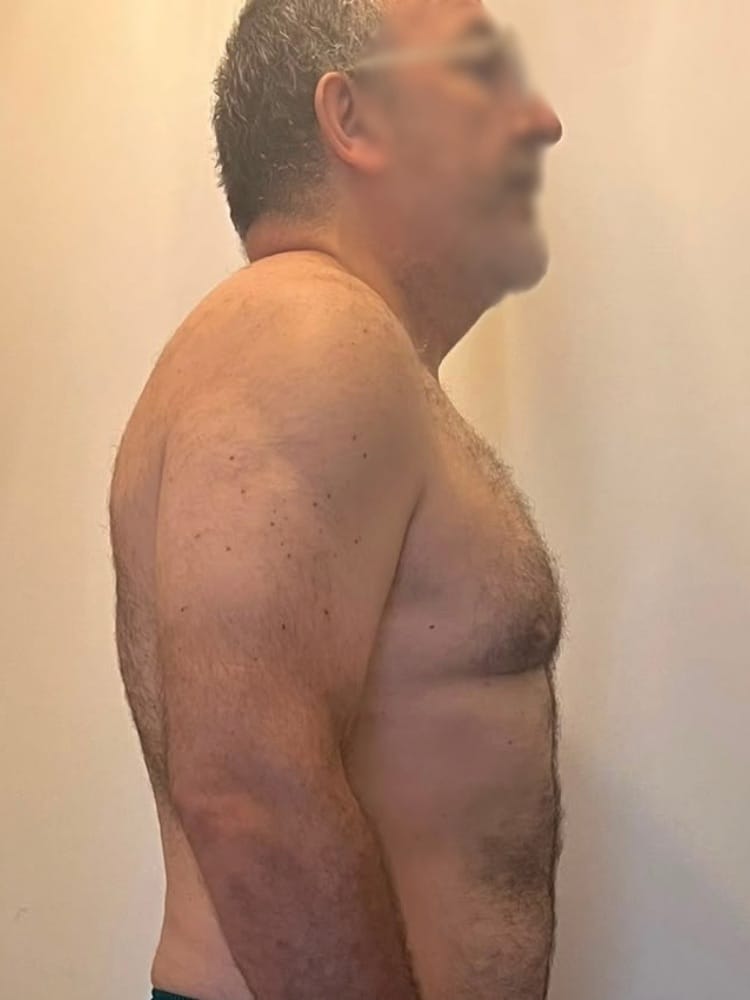 Slimane après