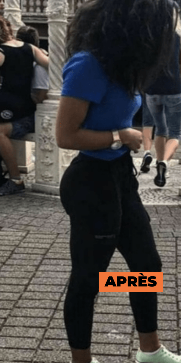 Après