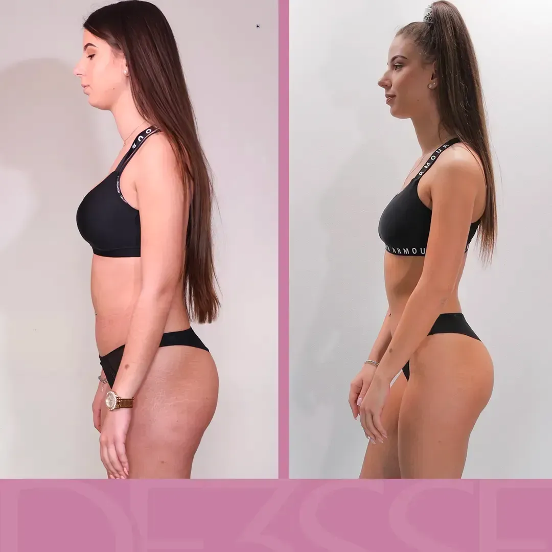 Transformation de Sandra