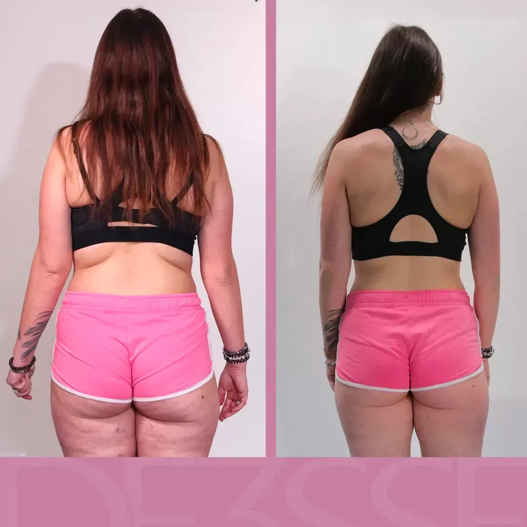 Transformation de Lisa