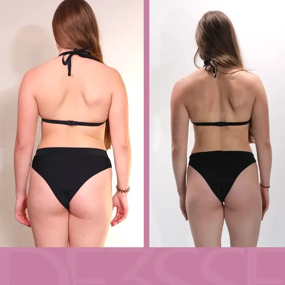 Transformation de Lisa