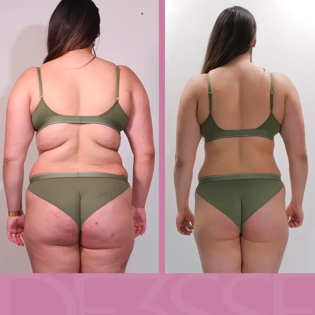 Transformation de Bérangère